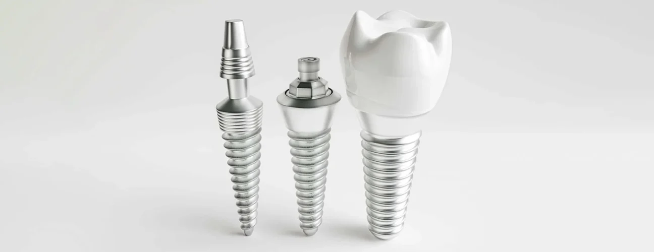 why-you-need-a-dental-implant